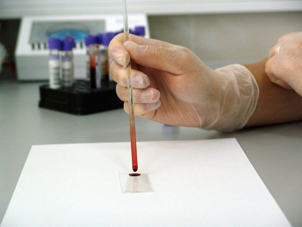 blood, sample, lab